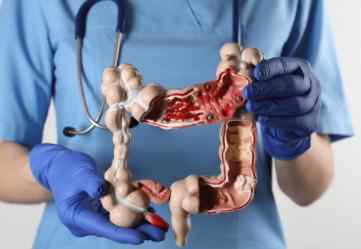 腸阻塞症狀 腸阻塞症狀